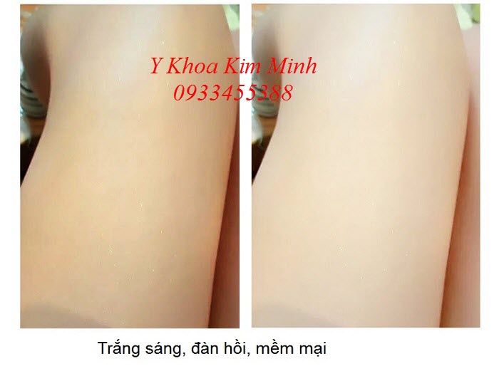 Công nghệ hấp trắng da nhanh hơn, an toàn hơn Giup trang da nhanh hon, an toan hon - Y khoa Kim Minh