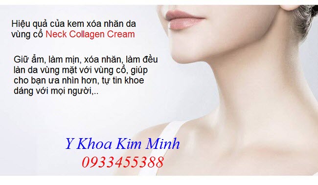 Hiệu quả sử dụng kem xóa nhăn da vùng cổ Neck Collagen Cream - Y Khoa Kim Minh 0933455388