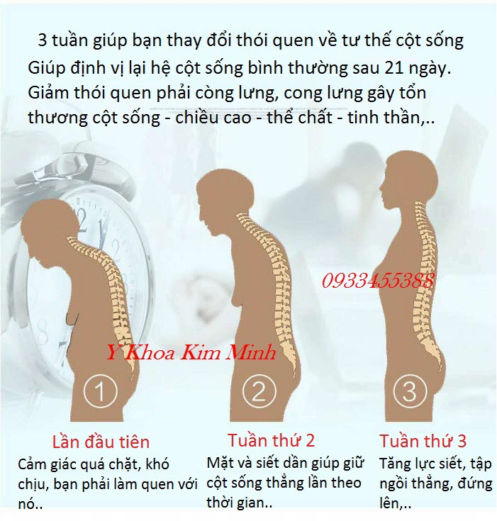 Hướng dẫn cách dùng đai chống gù lưng vẹo cột sống DL-031 bán tại Y khoa Kim Minh