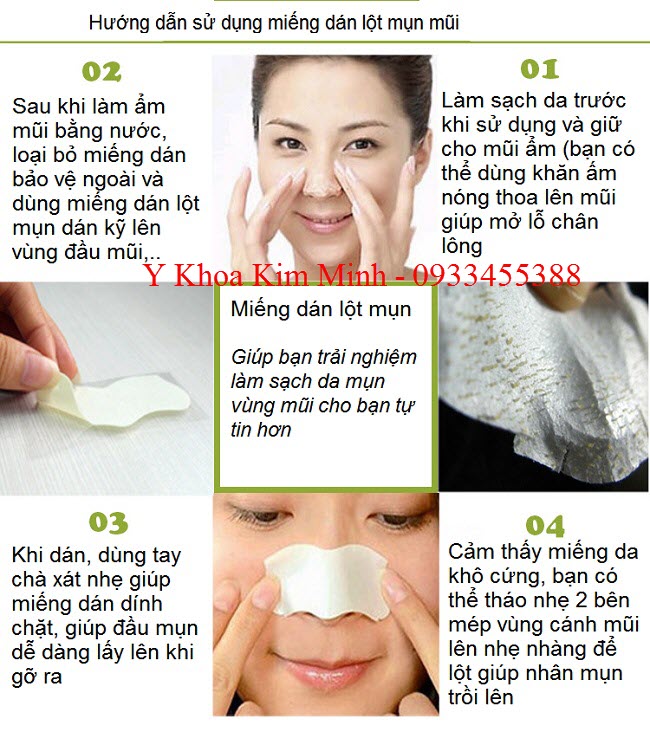 Cách dùng miếng dán lột mụn mũi - Y Khoa Kim Minh Hướng dẫn cách dùng miếng dán lột mụn mũi - Y Khoa Kim Minh 0933455388