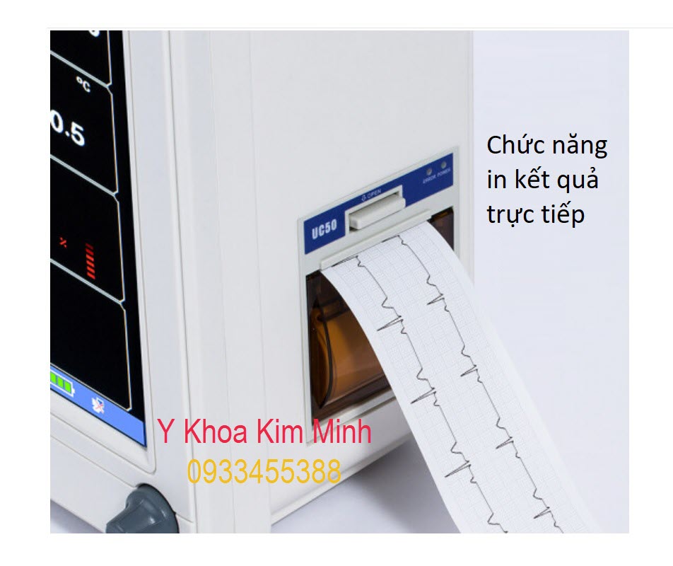 Chức năng in kết quả của bệnh nhân từ monitor MK-6800