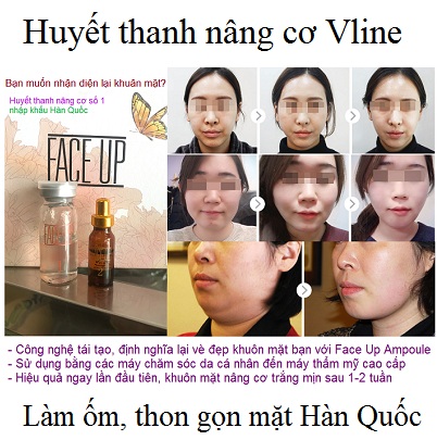 Huyết thanh nâng cơ, Vline, làm ốm da vùng mặt Face Up nhập khẩu Hàn Quốc - Y khoa Kim Minh