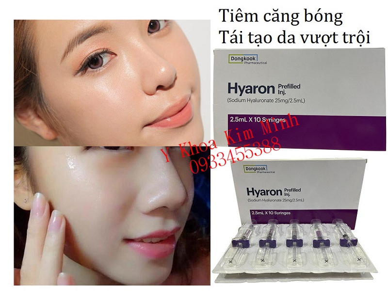 Hyaron tiêm căng bóng và trẻ hoá da vượt trội nhập khẩu Hàn Quốc