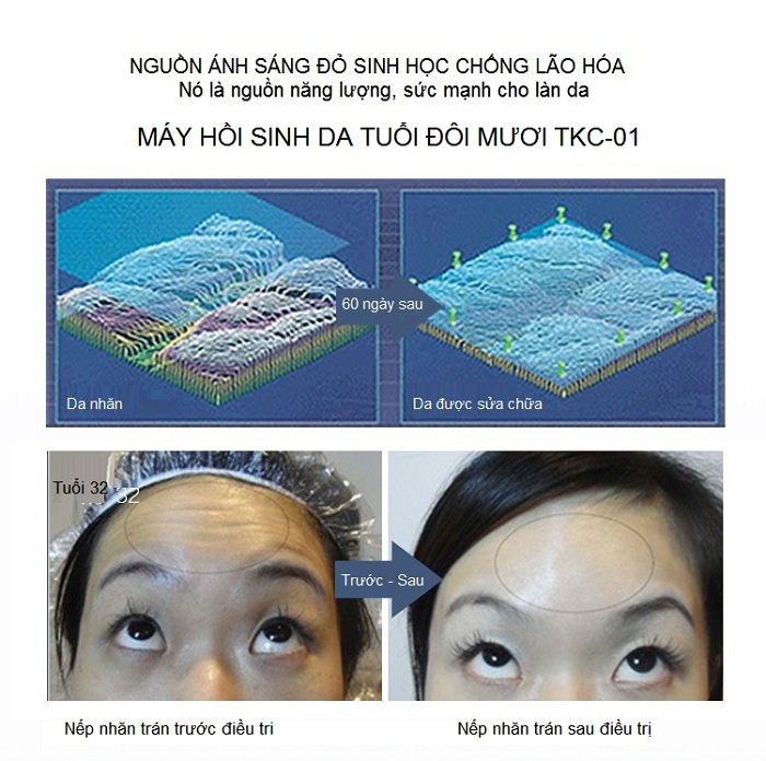 Máy hấp trắng hồi sinh da tuổi đôi mươi KTC-01 - Y Khoa Kim Minh Máy hấp trắng hồi sinh da tuôi đôi mươi bán tại Tp Hồ Chí Minh - Y Khoa Kim Minh