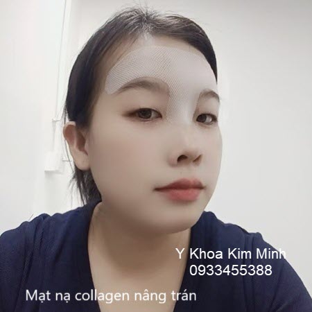 Mặt nạ collage nâng trán chống nhăn