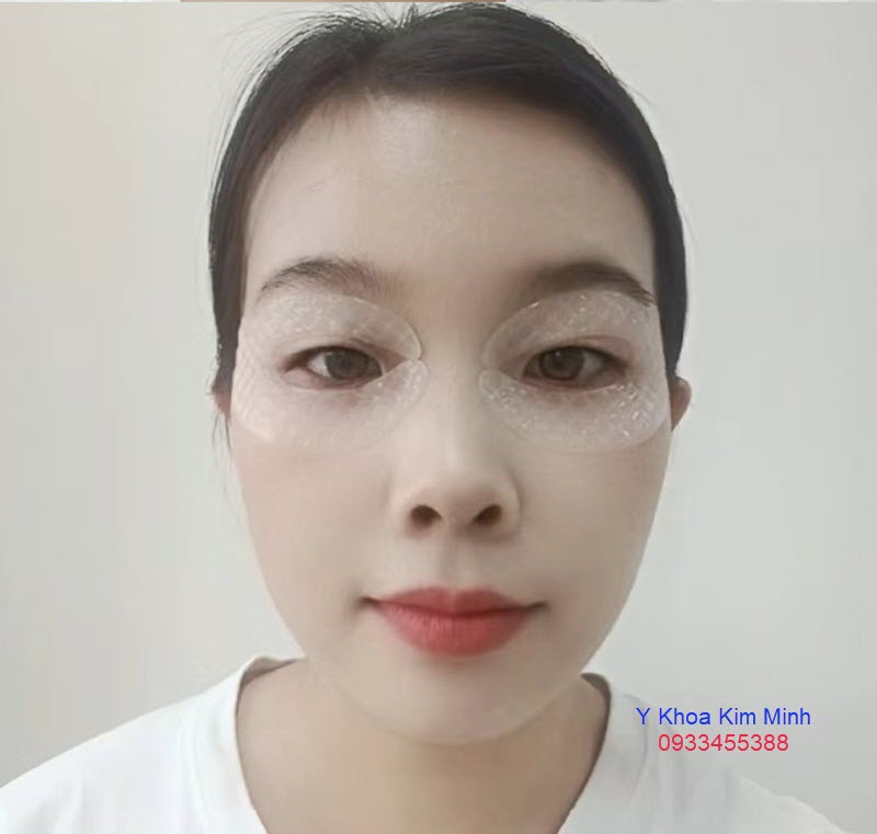Mặt nạ collagen ủ dưỡng da vùng mắt, chăm sóc da mắt bán ở tphcm