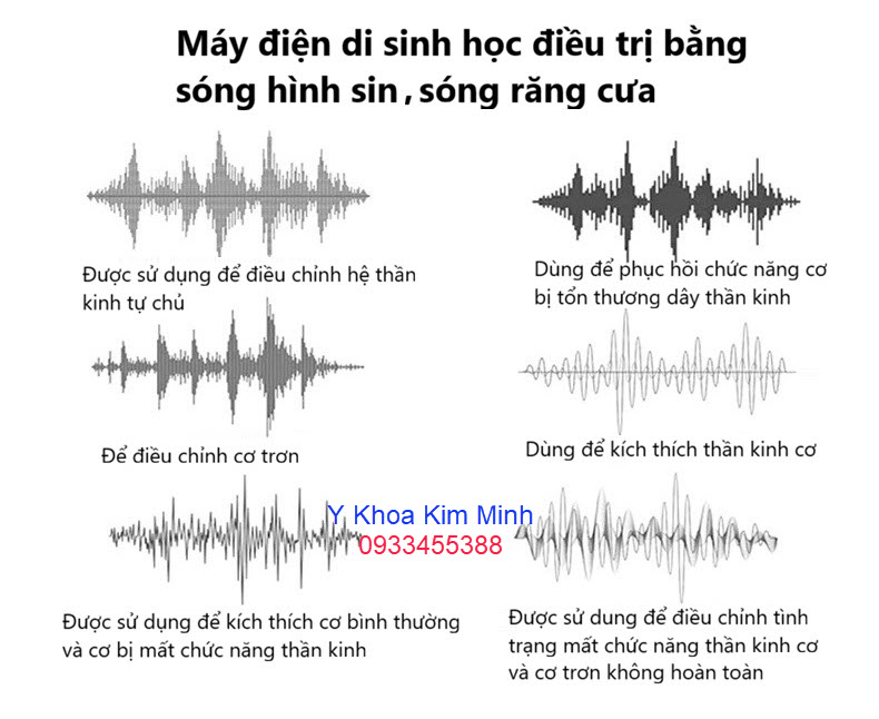 Công nghệ điều trị sóng điện di sinh học cho người bị bệnh thần kinh ngoại biên có chứng tê tay, cứng cơ, đau tắt nghẽn khí huyết cục bộ