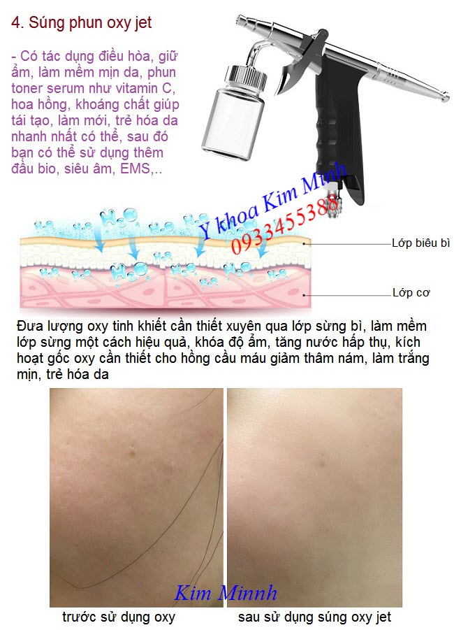 Súng phun oxy của máy Rayhero - Y Khoa Kim Minh Súng phun oxy của máy oxy jet thẩm mỹ Rayhero - Y khoa Kim Minh 0933455388
