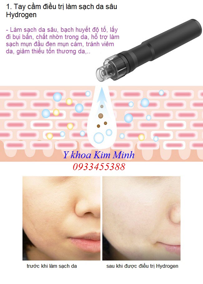 Tay cầm làm sạch da sâu Hydrogen - Y khoa Kim Minh May oxy jet Rayhero, tay cầm làm sạch da sâu Hydrogen - Y khoa Kim Minh 0933455388