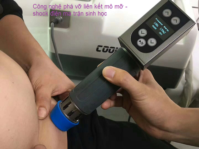 Shock điện sinh học ma trận phá liên kết mỡ - Y khoa Kim Minh Liệu pháp phá liên kết mỡ bằng shock điện sinh học ma trận coolwave - Y khoa Kim Minh