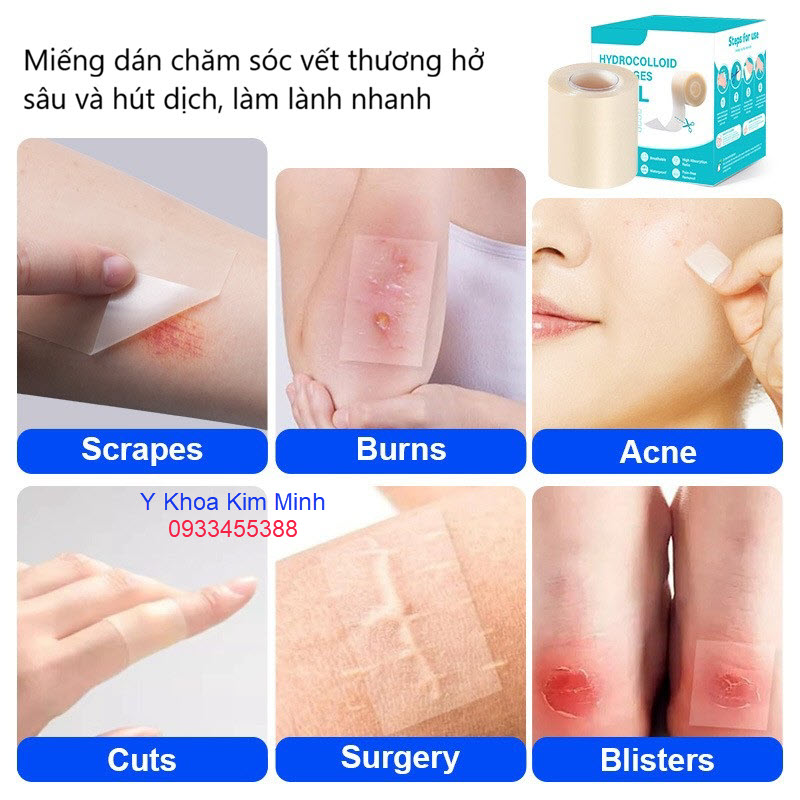 Miếng dán chăm sóc vết thương hở giúp lành nhanh bằng cách hút dịch vả bảo vệ vết thương