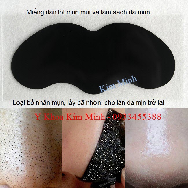 Miếng dán lột mụn mũi gel carbon - Y Khoa Kim Minh Bán miếng dán lột mụn mũi tại Tp Hồ Chí Minh - Y Khoa Kim Minh 0933455388