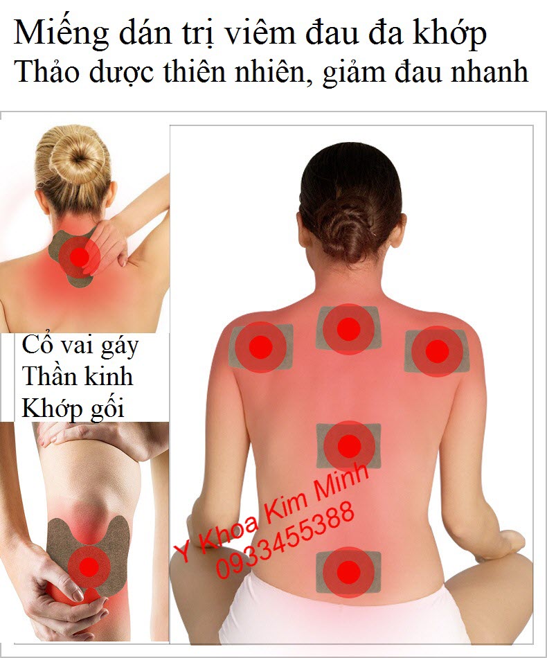 Miếng dán trị viêm đau đa khớp - Y khoa Kim Minh