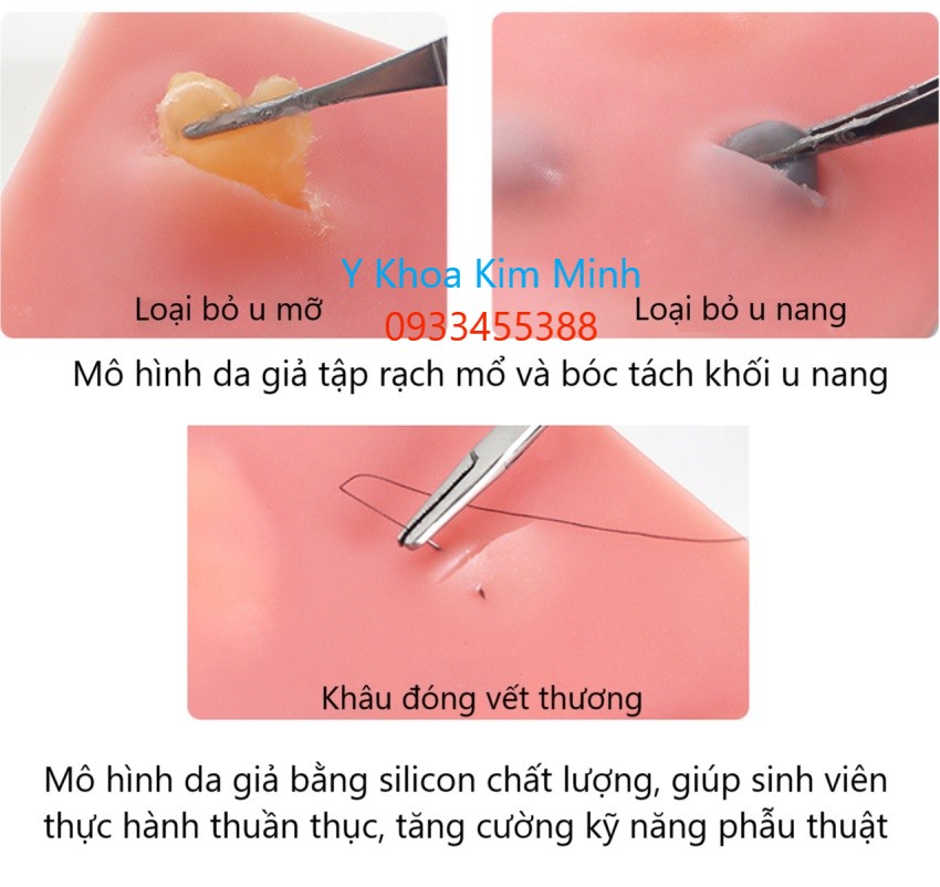 Mô hình da giả tập mổ bóc tách khối u nang, xơ nang