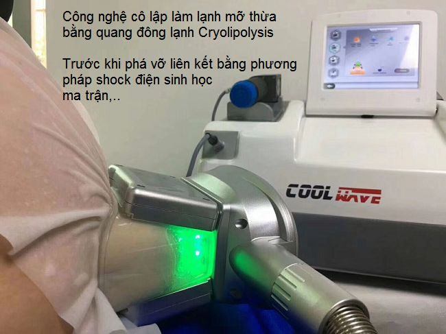 Chế độ hoạt động giảm béo bằng quang đông Cryolipolysis Coolwavve - Y khoa Kim Minh Chế độ hoạt động giảm béo bằng quang đông lạnh Cryoipolysis Coolwave - Y khoa Kim Minh 0933455388