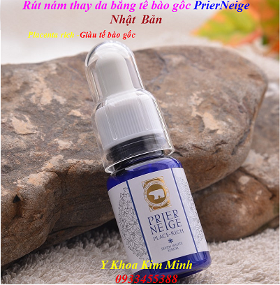 Rút nám thay da, chữa da nám sạm, ngăn chặn da tăng sắc tố Melanin bằng tế bào gốc Nhật Bản Prier Neige - Y khoa Kim Minh Rut nam thay da, chua tri nam sam, giam tang sac to melanin bang te bao goc Prier Neige Nhat Ban - Y khoa Kim Minh