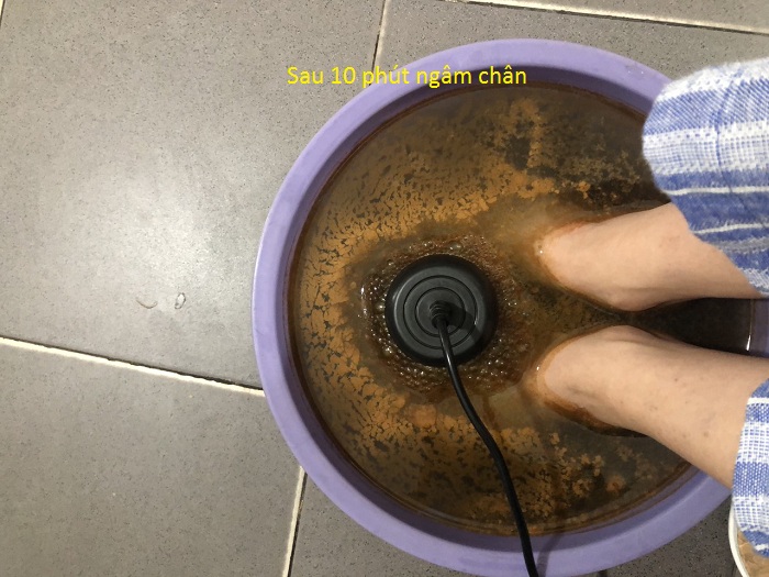 Hiệu quả sau 10 phút ngâm chân thải độc tố bằng máy KM-601 - Y khoa Kim Minh
