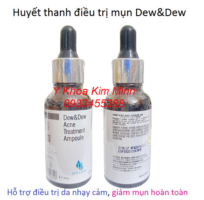 Dew&Dew Acne Treatment Ampoule được các bạn da mụn thường sử dụng rất hiệu quả ngăn mụn tái phát