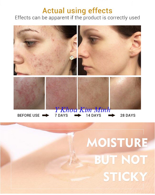 Snail Repair serum Breylee hiệu quả điều trị da tổn thương - Y Khoa Kim Minh Snail Repair Serum Breylee, dịch huyết thanh ốc sên dùng lăn kim tái tạo da - Y Khoa Kim Minh