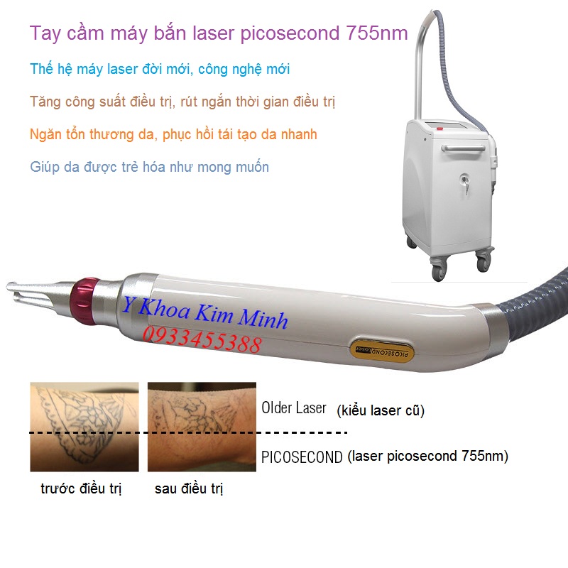 Tay cầm điều trị máy bắn laser picosecond 755nm trẻ hóa da và xóa xăm bán tại Tp Hồ Chí Minh - Y Khoa Kim Minh 09433455388