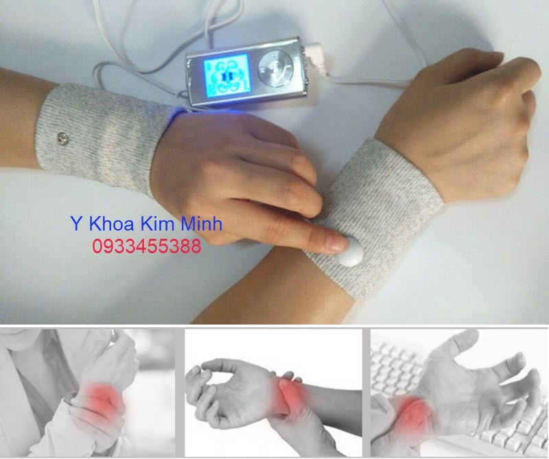 Trị đau nhức cổ tay, viêm cổ tay bằng vớ xung điện trị liệu dòng TENS