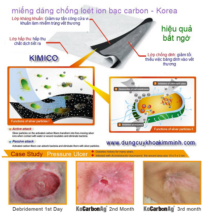 Su dung mieng dan dieu tri lo let lung nguoi benh nam liet, BCT ion carbon bac - Y Khoa Kim Minh