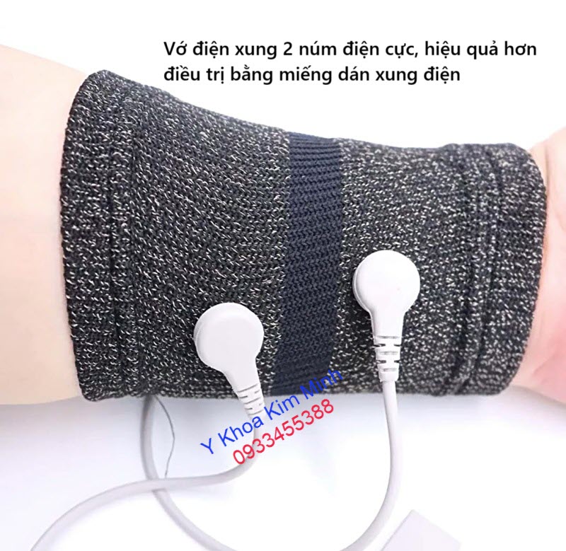 Vớ xung điện 2 núm điện cực điều trị viêm đau khớp cổ tay mạn tính, đau khớp cổ tay cấp tinh, thay thế phương pháp dùng miếng dán xung diện
