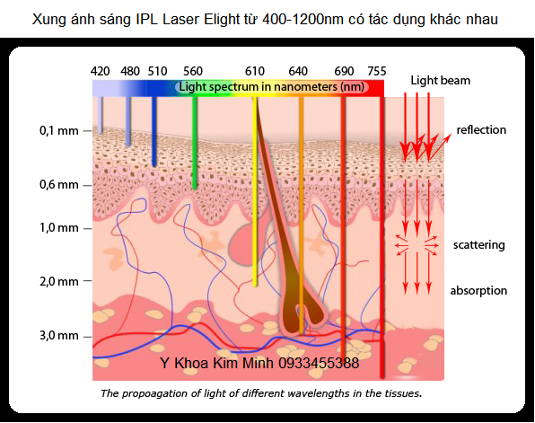 Xung ánh sáng IPL ngăn tia UV có hại trong tay cầm triệt lông Elight OPT Optic filter - Y Khoa Kim Minh 0933455388