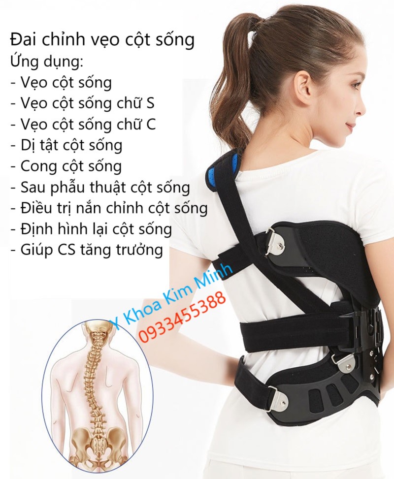 Công dụng của đai chỉnh vẹo cột sống KX-012 bán ở Y Khoa Kim Minh