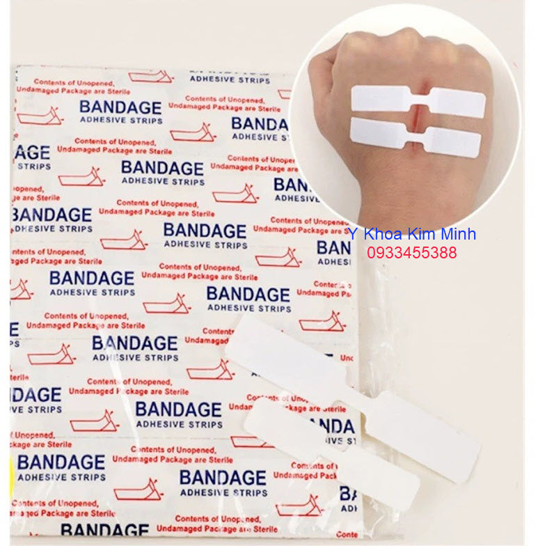 Miếng dán vết thương khâu cần khâu chỉ phẫu thuật